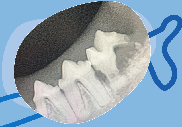 Radiología dental CV pitiuso